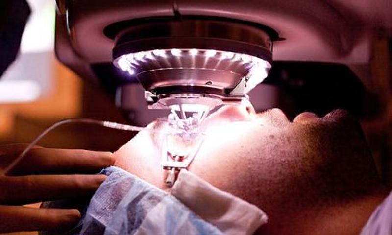 LASIK Consultation